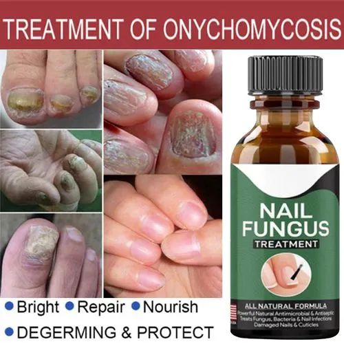 Nail Fungus Repair Serum